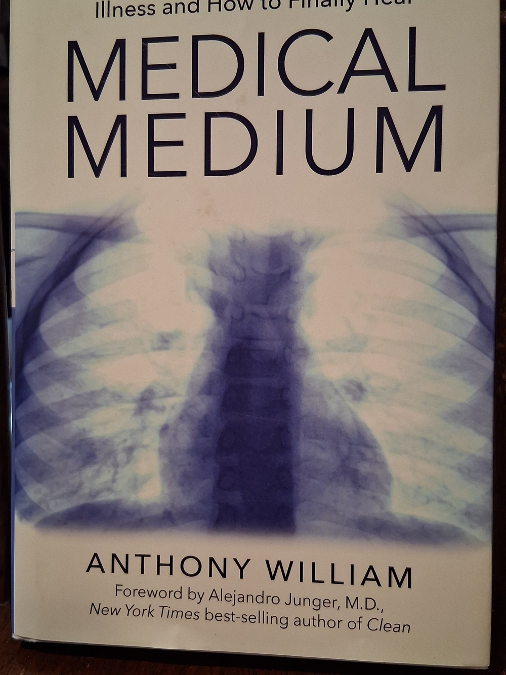 Medical Medium by Anthony William - Blue & White Cover